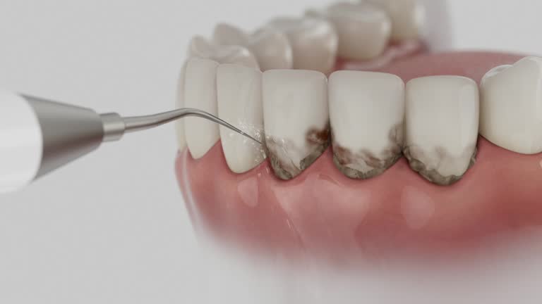 Trusted Root Canal Treatment service in Resaca, GA - Dentist Open Now